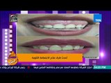 عسل أبيض - طبيبة الأسنان د. ألاء أيمن تشرح معنى 