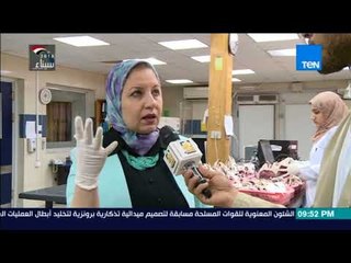 "رأي عام" في جولة بالمركز القومي لخدمات نقل الدم – فقرة كامة