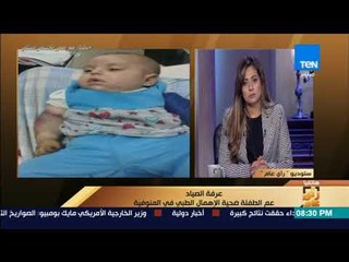 رأي عام - عم الطفلة ضحية الإهمال الطبي في المنوفية يروي تفاصيل بتر ذراعها