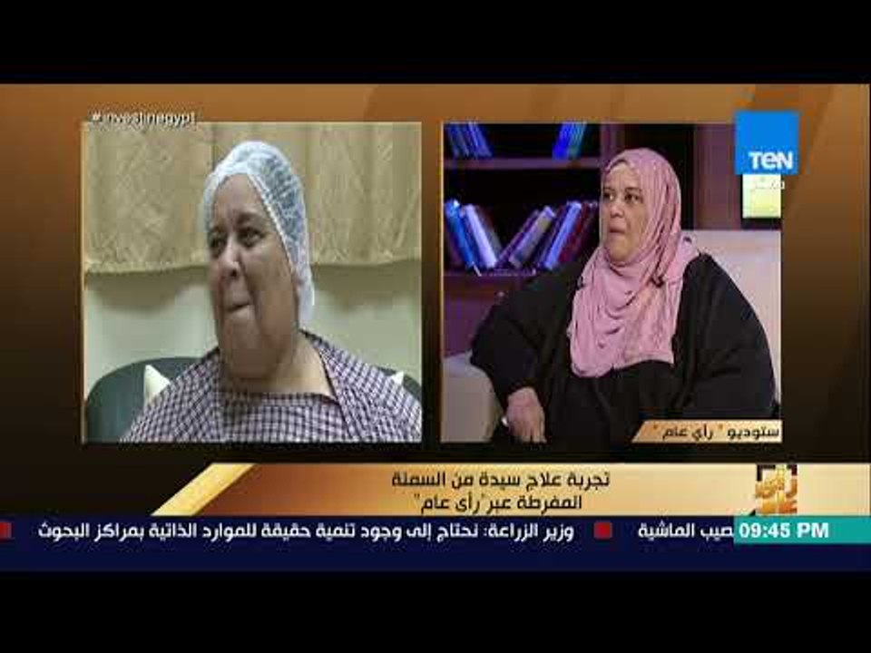 رأي عام - تجربة علاج سيدة من السمنة المفرطة عبر...