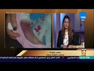 رأي عام - بعد بتر يدها بسبب الإهمال الطبي .. إجراءات حصول سلمى على حقها