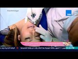كلام البنات - متابعة خاصة لحالة محمد ونور في عيادة الأسنان د.طارق الأشقر