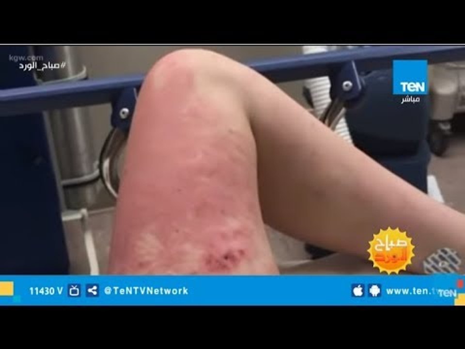 الهزار البايخ قد يعرضك للسجن.. فتاة تدفع زميلته...
