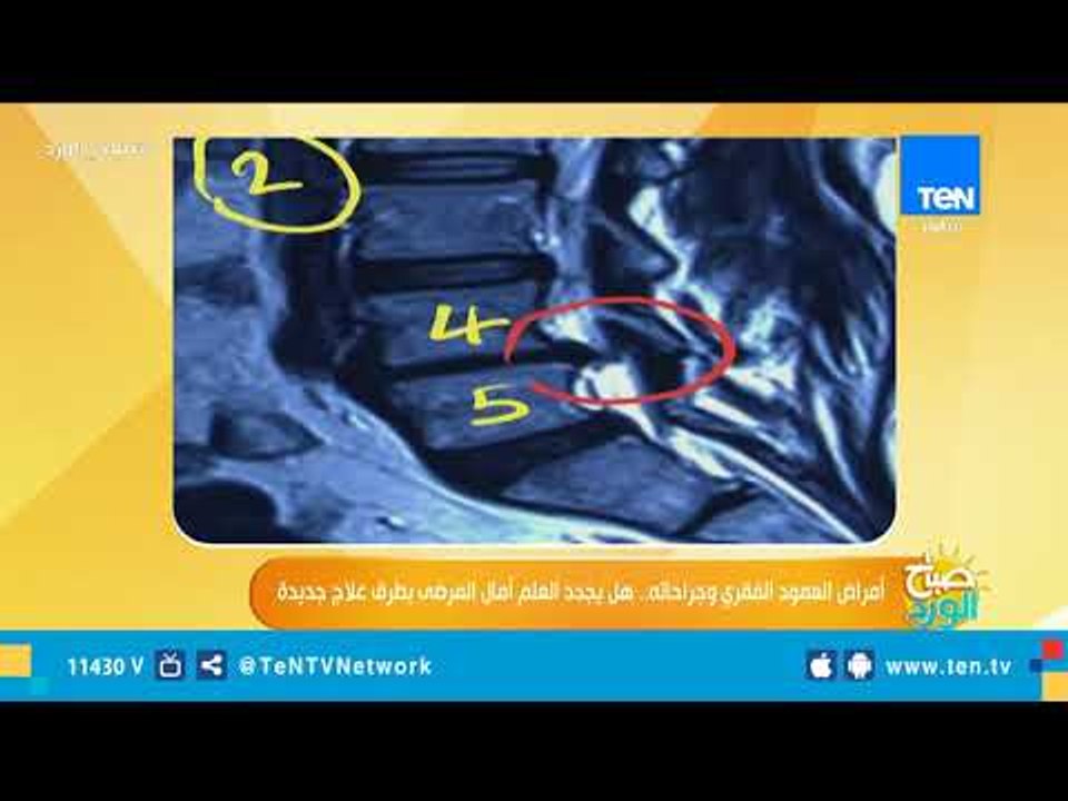 شوف الفرق بين الجراحة التقليدية وجراحة المنظار من أستاذ جراحة العظام والعمود الفقري بجامعة عين شمس