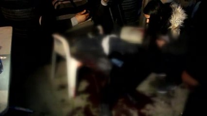 İş Yerlerinde Bıçaklanan İki Kardeş Ağır Yaralandı