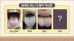 [HEALTH] If you look at your tongue, you know the disease?,기분 좋은 날20190304