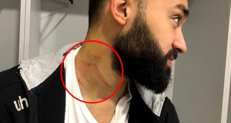Savcılık, "Amedsporlu Futbolcular Sivri Cisimle Saldırdı" İddiasına Soruşturma Başlattı