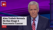 Jeopardy Fans Stunned: Alex Trebek Has Stage 4 Cancer