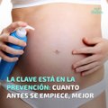 Trucos para prevenir estrías embarazo