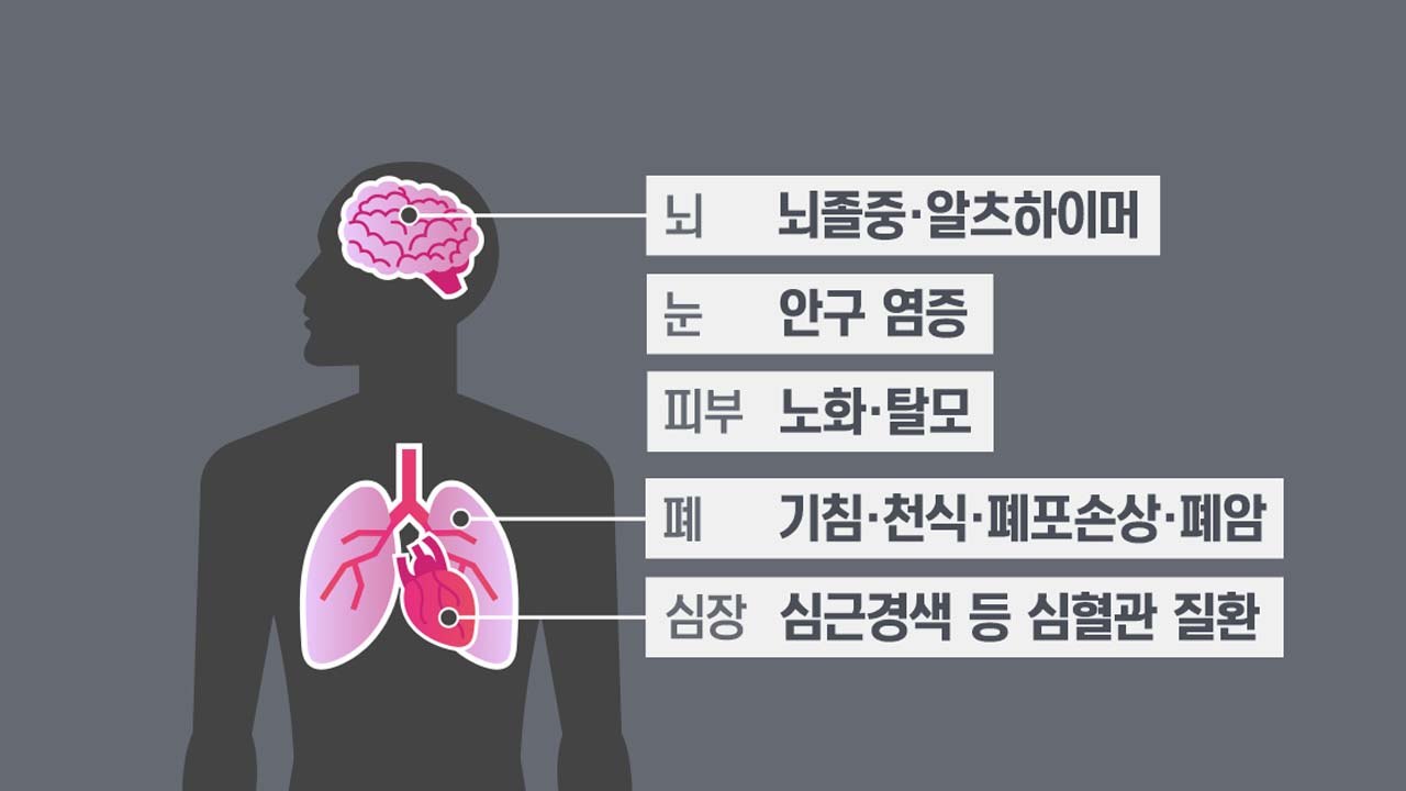[뉴스TMI] '침묵의 살인자' 미세먼지가 건강에 미치는 영향은? / YTN