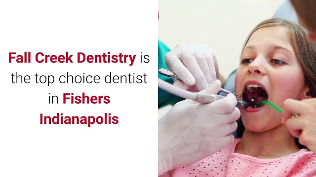 Veneers Fishers | 3175968000 | fallcreekdentistry.com