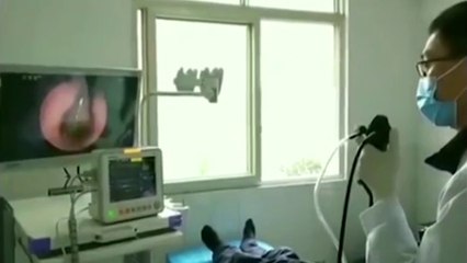 Horrible : des médecins trouvent une sangsue de 10 centimètres dans la gorge d’un patient