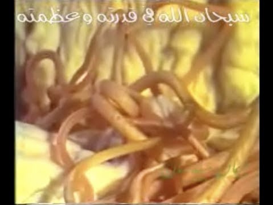 سبحان الله في قدرته وعظمته شاهد عائلة الديدان في بطن الإنسان