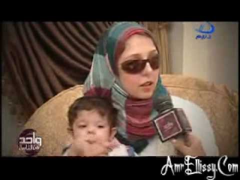 واحد من الناس - عمرو الليثي والحالات الانسانية - الطفلة نور هشام واصابتها بعيب خلقي في المرئ