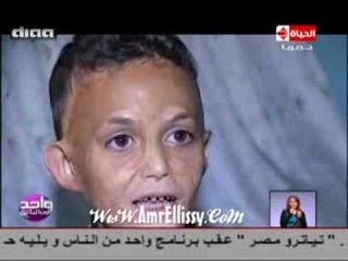 برنامج واحد من الناس : الحالات الانساية للطفل محي 28/2/2014 مع د.عمرو الليثي