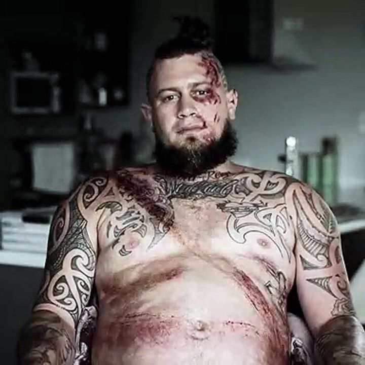 Voilà à quoi ressemble la marque laissée par la ceinture de sécurité après une collision en voiture