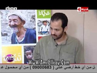 #واحد من الناس | متابعة حالة محمد احمد بعد العملية | مع د.عمرو الليثي