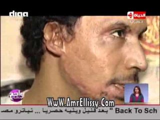 #واحد من الناس | الحالات الانسانية 13-2-2015 | مع د.عمرو الليثي