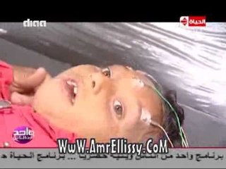 #واحد من الناس | متابعة حالة رحمة وصفاء مختار و جهاد مصطفي | مع د.عمرو الليثي