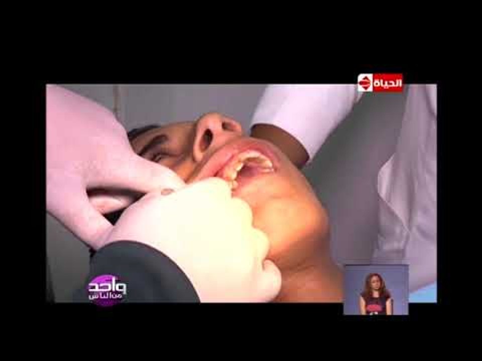 واحد من الناس - حالة الطفل "نور" البرنامج يقوم ببداية مراحل علاجه مع مركز "الحياة" للأسنان