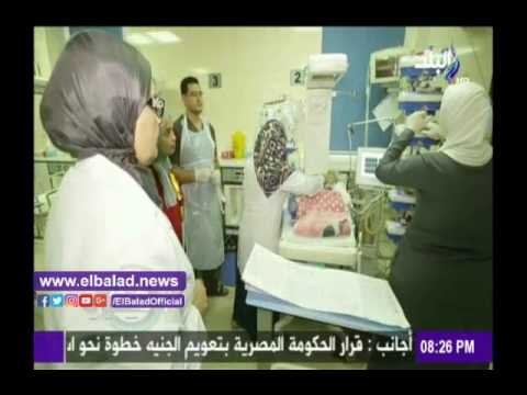 صدى البلد | أبو الريش: 400 طفل مريض بالقلب بقوائم الانتظار