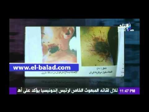 المتحدث باسم الطب الشرعي يكشف لـ أحمد موسي تفاصيل مقتل شيماء الصباغ
