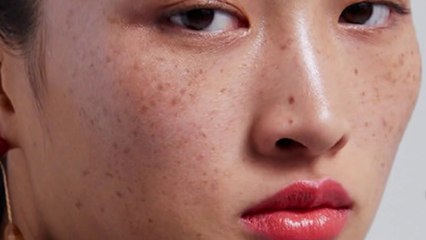 Sans frontières - Chine : les taches de rousseur de la discorde