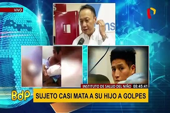 INSN-San Borja: brindan detalles del estado de salud de menor golpeado por su padre