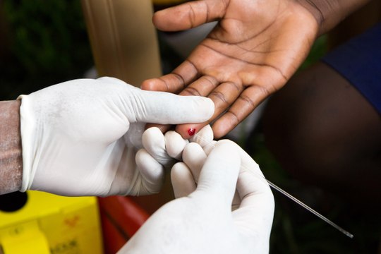 An HIV Patient In London Has Been Cured Of The Disease