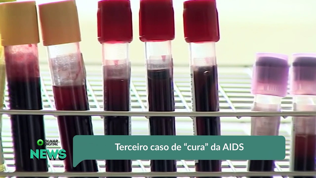 Terceiro caso de “cura” da AIDS