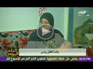 حالة انسانية...يونس مولود عجز الطب عن علاجه ويحتاج للمساعدة