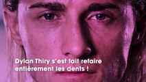 Dylan Thiry : la somme astronomique dépensée pour refaire ses dents