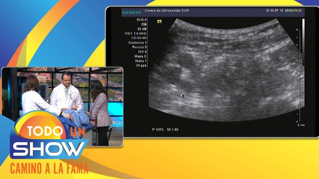Todo Un Show | ¡Ultrasonido para diagnosticar con precisión la causa de dolores en la cadera!