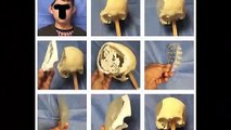 Hospitales Civiles de Guadalajara usan 3D para reconstrucción de cráneos