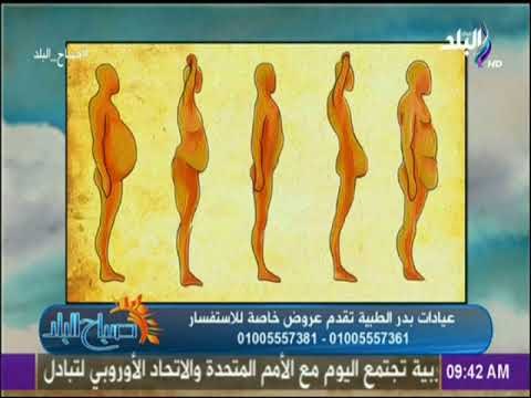 صباح البلد - تعرف علي افضل طرق التخلص من الكرش مع الدكتور أشرف سمعان