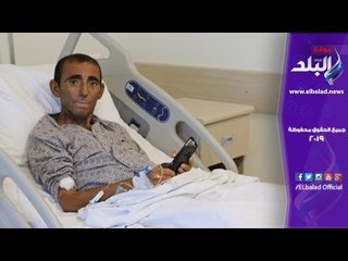 صدى البلد | شاب تركي يعيش بـ 5 كلى في جسده