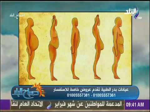 صباح البلد - الدكتور أشرف سمعان: الدايت نتائجة محدودة وشفط الدهون حل جزري للدهون الموضعية