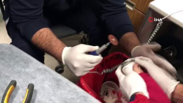 Küçük çocuğun parmağına sıkışan metal parça CANKUR ekipleri tarafından kesilerek çıkartıldı
