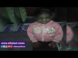 صدى البلد |طفلة تحير الأطباء.. طفح جلدي يصيبها بورم ووالدها يستغيث لعلاجها
