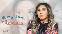 الممثلة مها المصري تروي تجربتها مع عملية التجميل التي خضعت لها