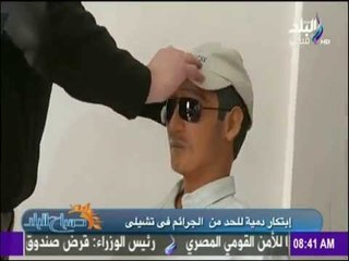 تشيلي تقلد الفلاح المصري بإختراع جديد للحد من السرقة | صباح البلد