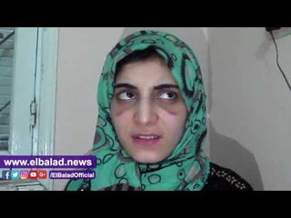 صدى البلد |زوجة الفيوم "ضحية الفيسبوك" لصدى البلد زوجي قيدني بالحبال وانهال على جسدي بالشومة