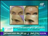 طبيب البلد - كيفية إزالة تجاعيد الوجه وتحت العين مع الدكتورة أمينة البدري