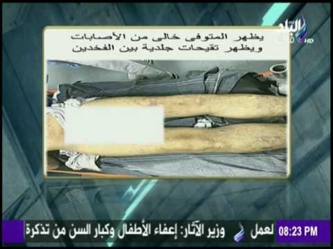 على مسئوليتي - أحمد موسى يكشف حقيقة الصور المفبركة للمواطن مجدي مكين