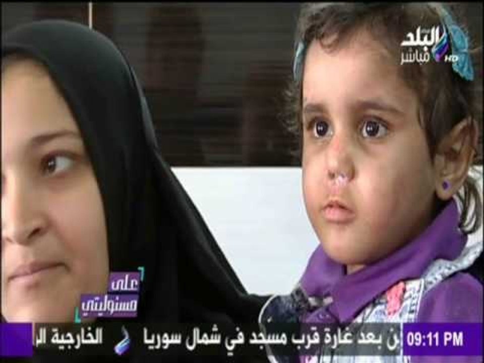 على مسئوليتي - أحمد موسى - شاهد ما وصلت اليه حالة الطفلة تقي ضحية التعذيب