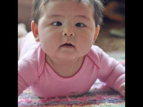 صدى البلد | تعرف على أنواع الحول في العين عند الاطفال