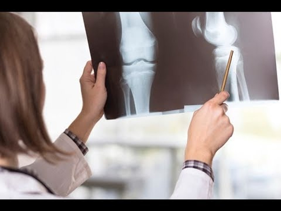 صدى البلد | 6 أعراض خطيرة تنتظر المرأة في سن اليأس.. أبرزها هشاشة العظام
