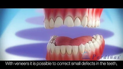 ونیر دندانپزشکی | کلینیک تاج 🦷