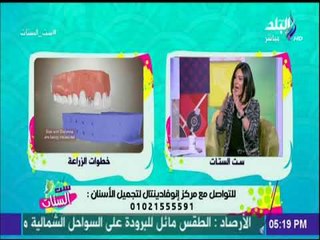 ست الستات - تعرف على تطورات زراعة الاسنان في العالم - د.محمد عاطف