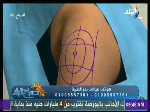 انواع عمليات نحت القوام - د. أشرف سمعان | صباح البلد